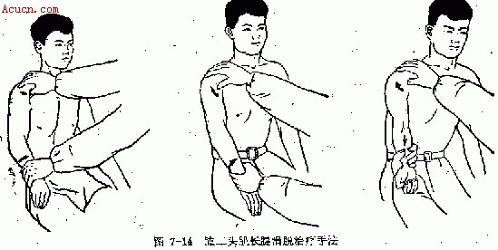 推拿肩部伤筋肱二头肌长腱滑脱