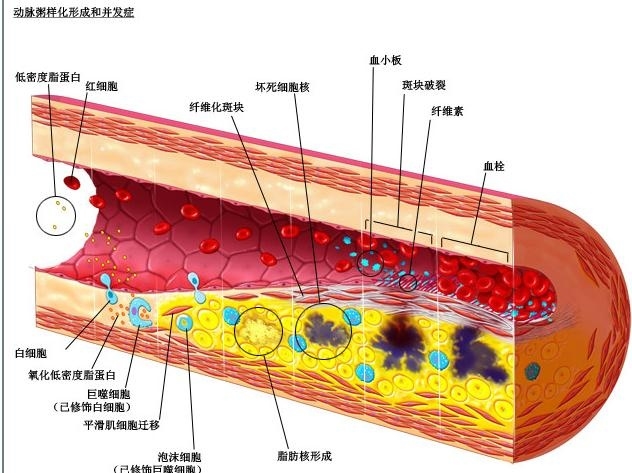 心脏解剖图