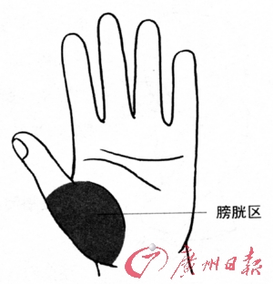 手区图解:膀胱区位于大鱼际区 提示病症:膀胱结石,膀胱炎,膀胱癌