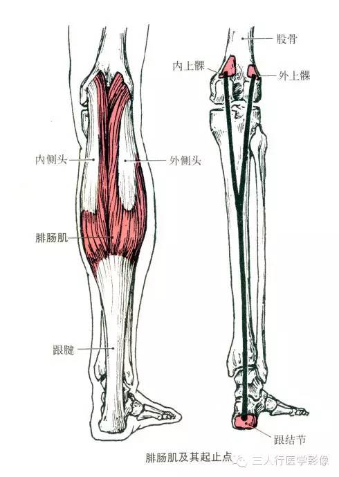 功能:近固定时,使踝关节屈(跖屈),腓肠肌还可使膝关节屈.