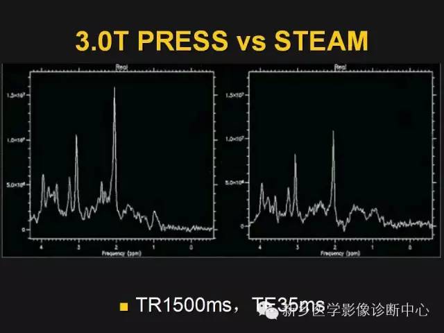 完美的磁共振波谱(mrs)技术详解