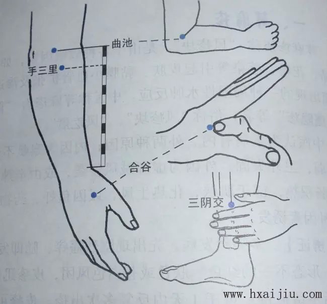 肠火上牙痛,请掐按合谷,曲池,手三里  胃火下牙痛,请掐按双侧内庭