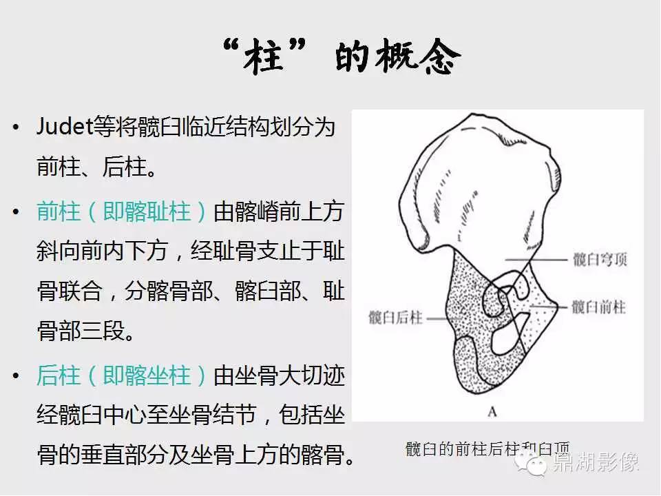 【聚沙成塔】髋臼骨折那些我们忽略的细节(壹)