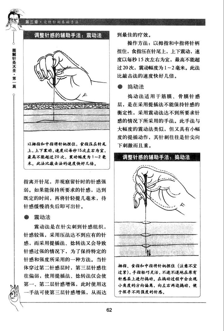 图解针灸大全【上】