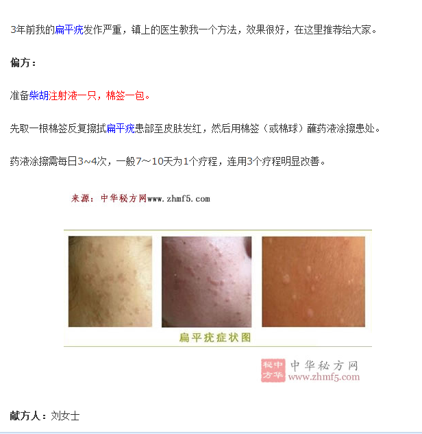 用柴胡注射液治扁平疣偏方,简单且有效!