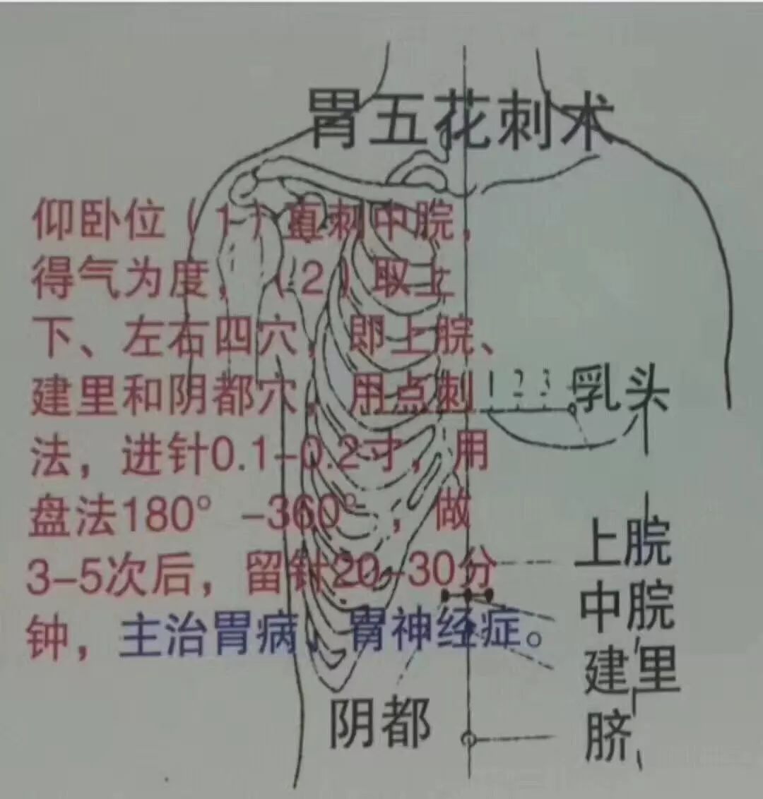 中医针灸各种刺法(图文讲解)