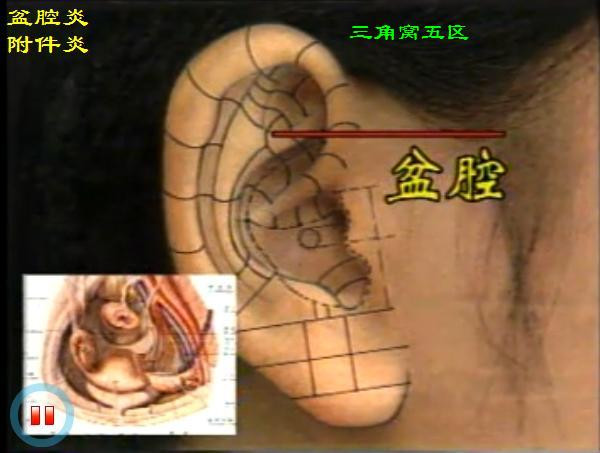 耳穴详解(真人耳穴图片)
