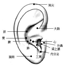 家传耳尖放血 【草根一生】