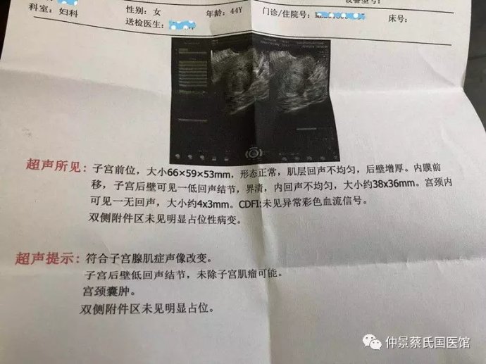 蔡长友治疗子宫腺肌症医案