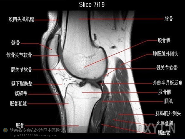 膝关节结构示意图