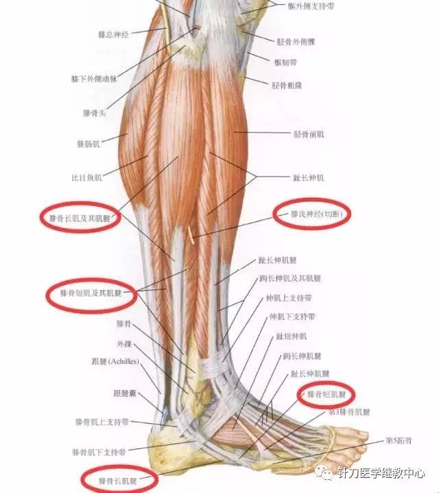 上方的箭头指的是腓骨短肌肌腱,下方箭头指的是腓骨长肌肌腱.18.
