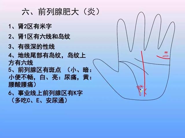 手诊图解大全完整版