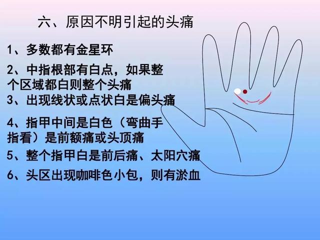 手诊图解大全完整版