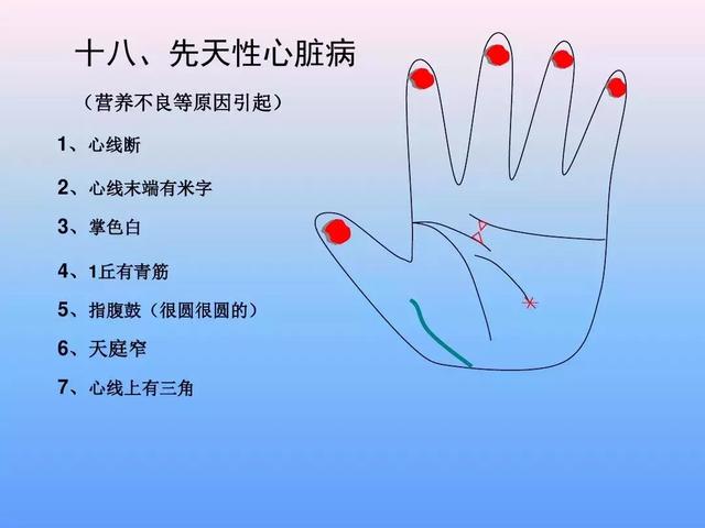 手诊图解大全完整版