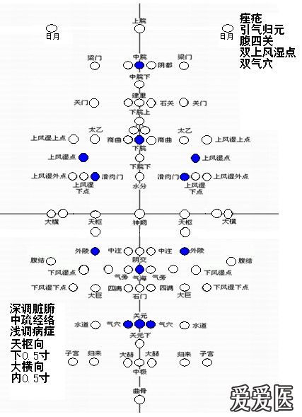 【专业篇】腹针疗法经验原理及处方整理 好网角文章收藏