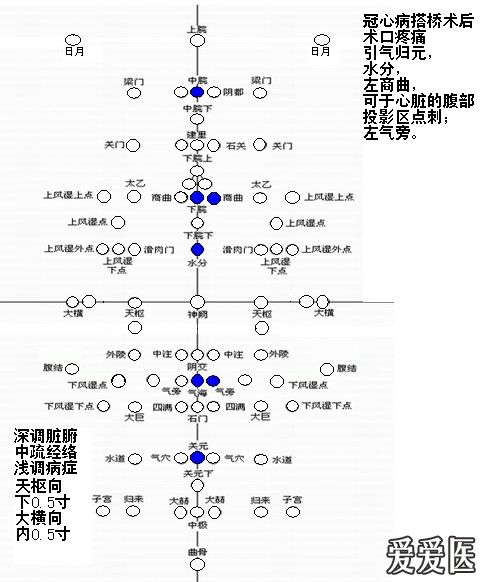 专业篇腹针疗法经验原理及处方整理