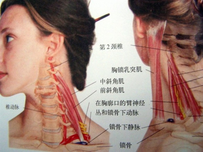 【桡侧麻木的,一般选择颈5,6华佗夹脊【指尖放血即可【前中斜角肌