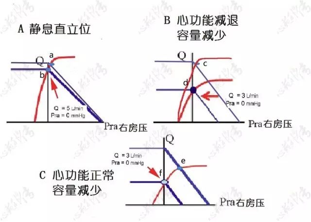 血流动力学上guyton静脉回流理论