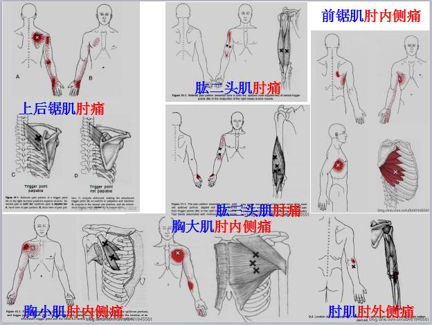 全身激痛点手册