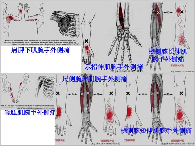 全身激痛点手册