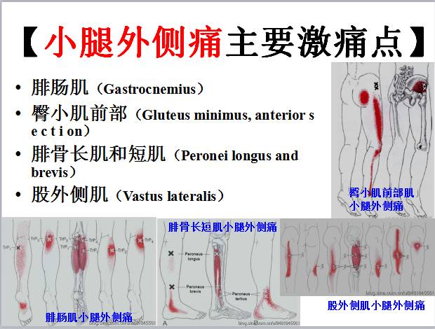 全身激痛点手册