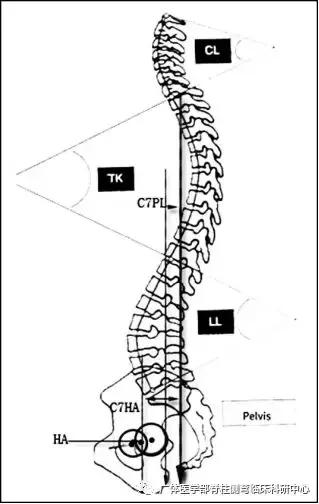 alignment,csa,胸椎后凸角(thoracic kyphosis,tk,腰椎前凸角