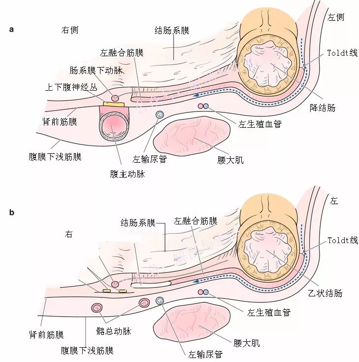 结肠的实用临床外科解剖