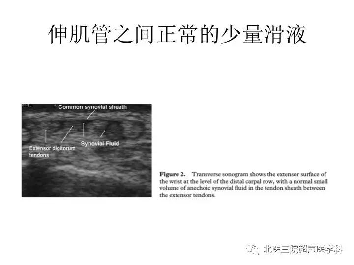 【文献汇报】腕关节的正常超声表现(一)