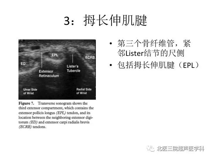 【文献汇报】腕关节的正常超声表现(一)