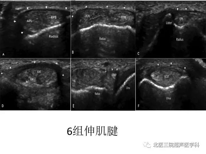 【文献汇报】腕关节的正常超声表现(一)