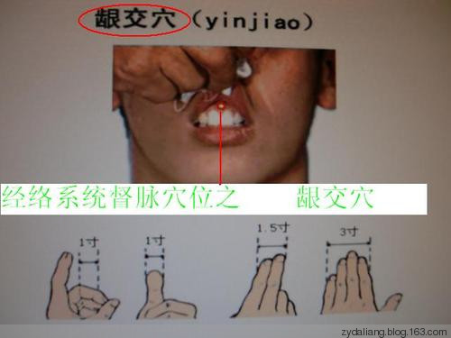 龈交穴治疗痔疮和尿频有奇效