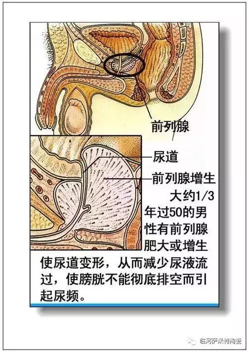 人体内脏分布概观简图 6.