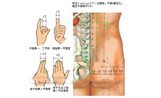 神阙拔罐更神奇针灸治疗坐骨神经痛治疗图合谷穴应用一得治疗急性腰