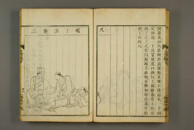 中医古籍——《正骨图说》