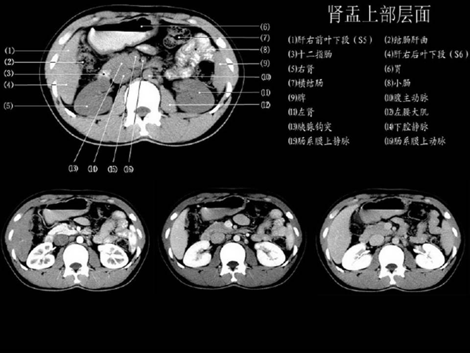 【ppt】正常肝脏ct解剖 – 影像ppt