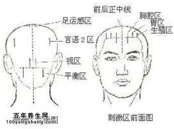 焦氏头针疗法刺激区的定位和主治作用