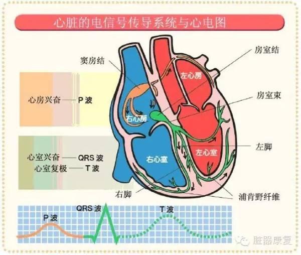 电路问题——就是心律失常,正常心脏应该从窦房结顺序传导,所以我们