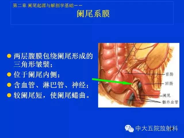 经典之作正常阑尾和阑尾炎的ct表现