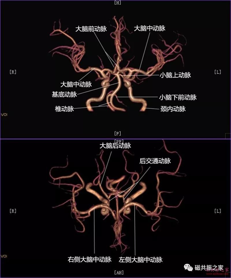 基底动脉系:主要供血幕下 颈内动脉系:主要供血幕上 颅内动脉大体解剖