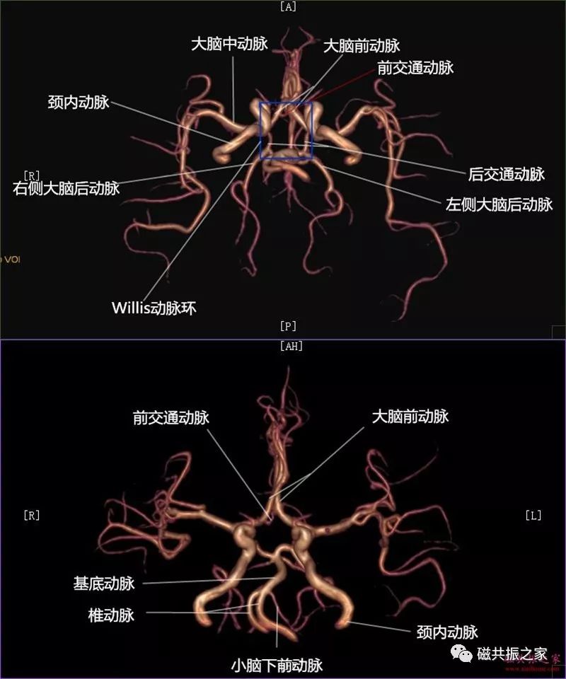 颅内动脉大体解剖颈内动脉系:主要供血幕上椎-基底动脉系:主要供涯换