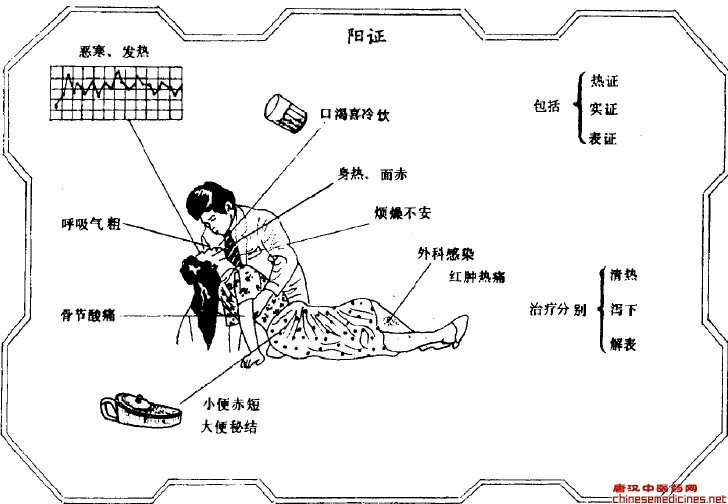 由于体液大量消耗所出现阴津衰竭的病变和证候,即现代医学热休克表现