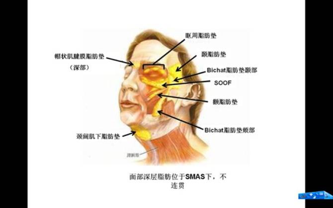 面部的脂肪分布图及瘦脸的运用