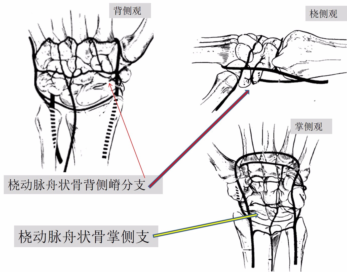 专题教程舟状骨骨折的7种手术入路详解