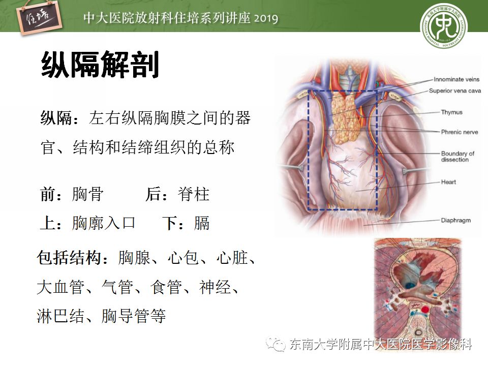 纵隔分区及常见纵隔占位的影像诊断