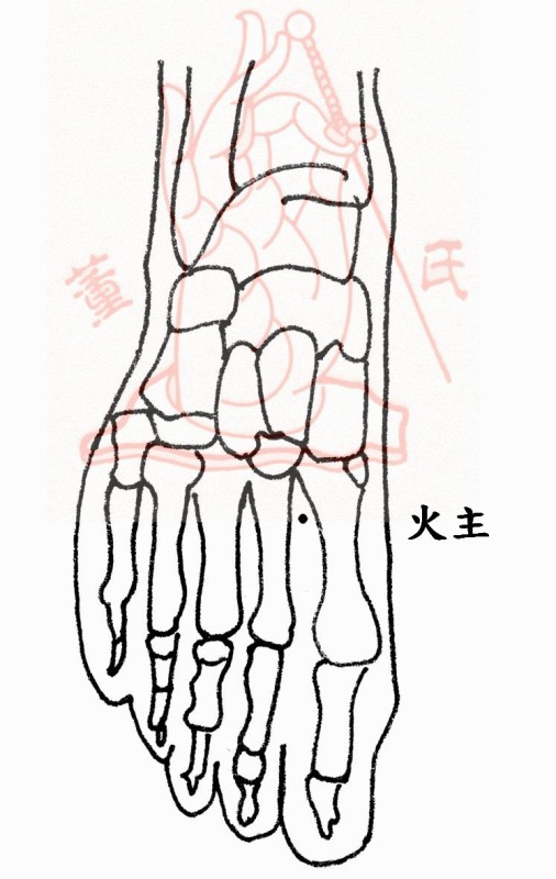 治疗后半夜定时醒来的失眠症