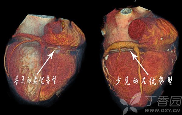 虫哥说图系列2心脏的血管解剖动脉篇静脉篇精华