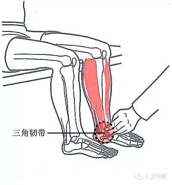 踝关节内侧副韧带也称三角韧带,常因跑,跳或从高处坠地而不慎扭伤,在