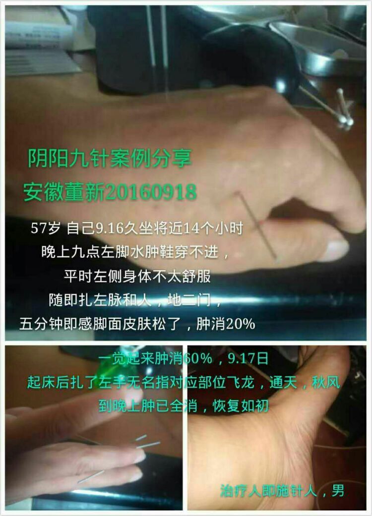 多种针法收集图解供爱好针灸的学友参考:收集制作 者:尤爱华~中医