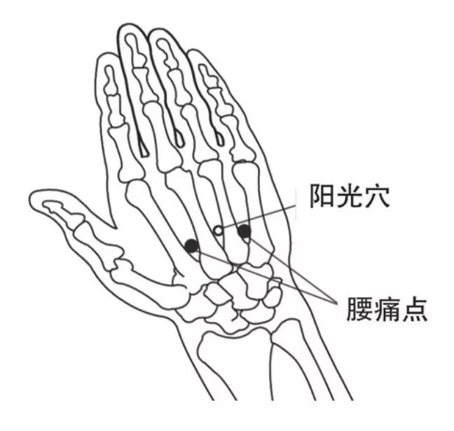 手上有个阳光穴治腰痛选它就对了