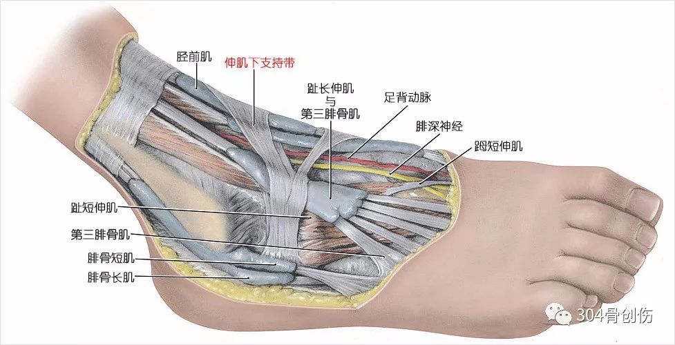 踝关节不稳定4踝伸肌下支持带解剖